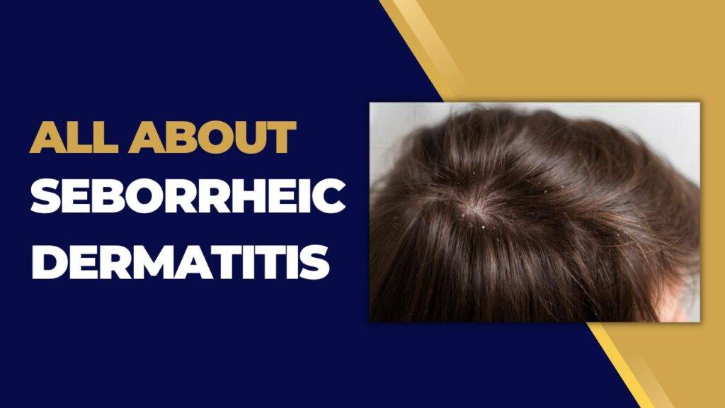 All About Seborrheic Dermatitis Nerdyinfo